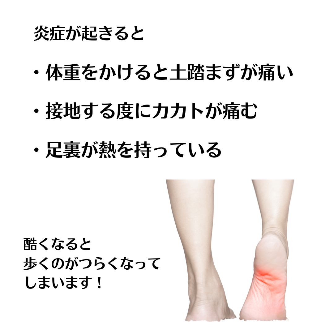 炎症が起きると「土踏まずが痛い」「踵が痛い」「足裏が熱を持っている」酷くなると歩くのがつらくなってしまいます