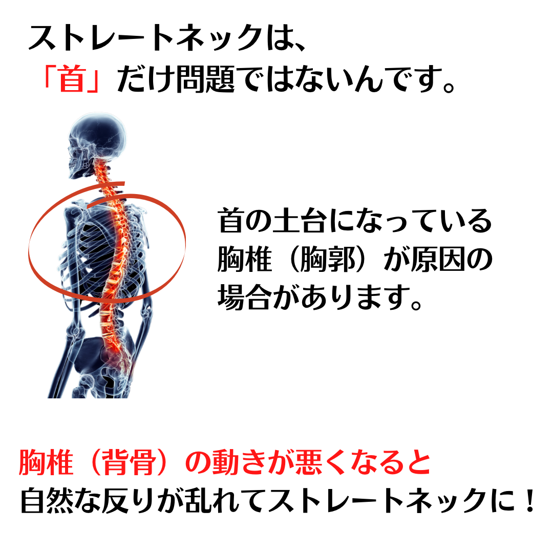 ストレートネックは首だけの問題ではないんです。首の土台になっている胸椎が原因の場合があります。胸椎の動きが悪くなると自然な反りが乱れてストレートネックになってしまうことがあります。