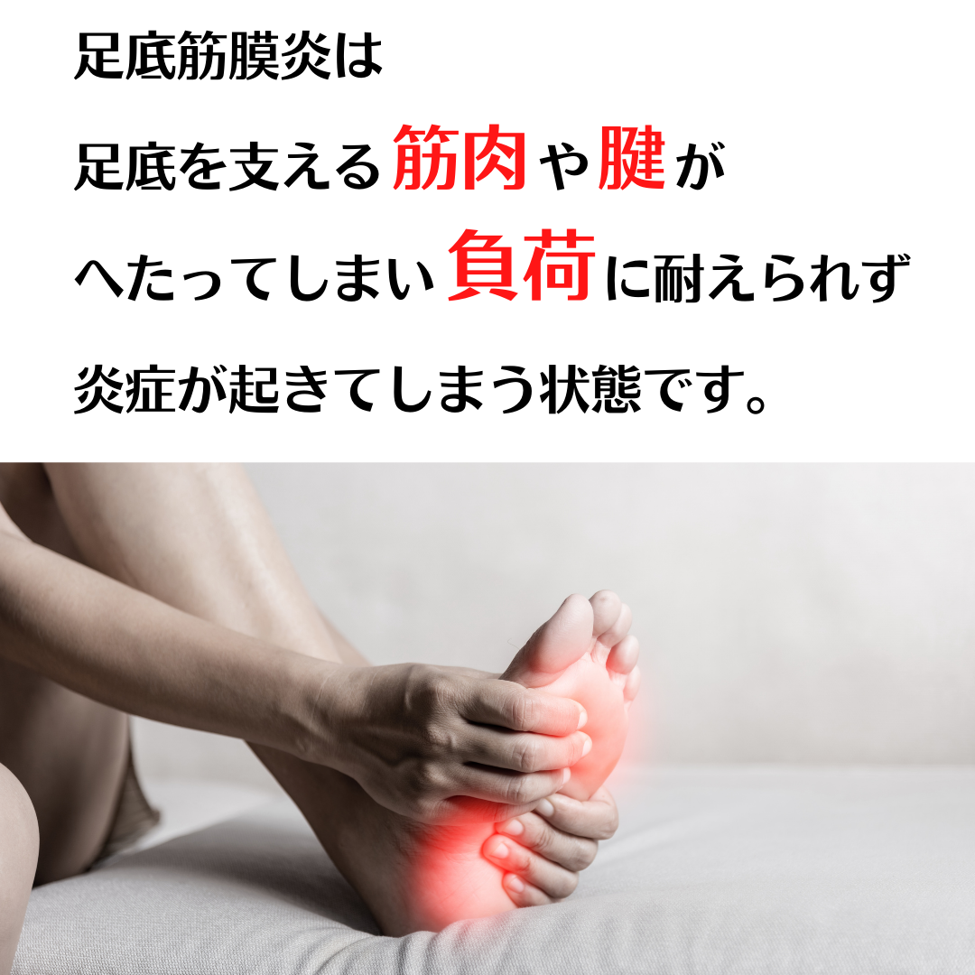 足底筋膜炎は足底を支える筋肉や腱がへたってしまい、負荷に耐えられず炎症が起きてしまう状態です