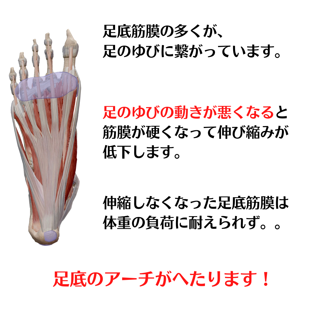 足底筋膜炎の多くが足のゆびに繋がっています。足のゆびの動きが悪くなると筋膜が固くなって伸び縮みが低下します。伸縮しなくなった足底筋膜は体重の負荷に耐えられず。。足底のアーチがへたります。