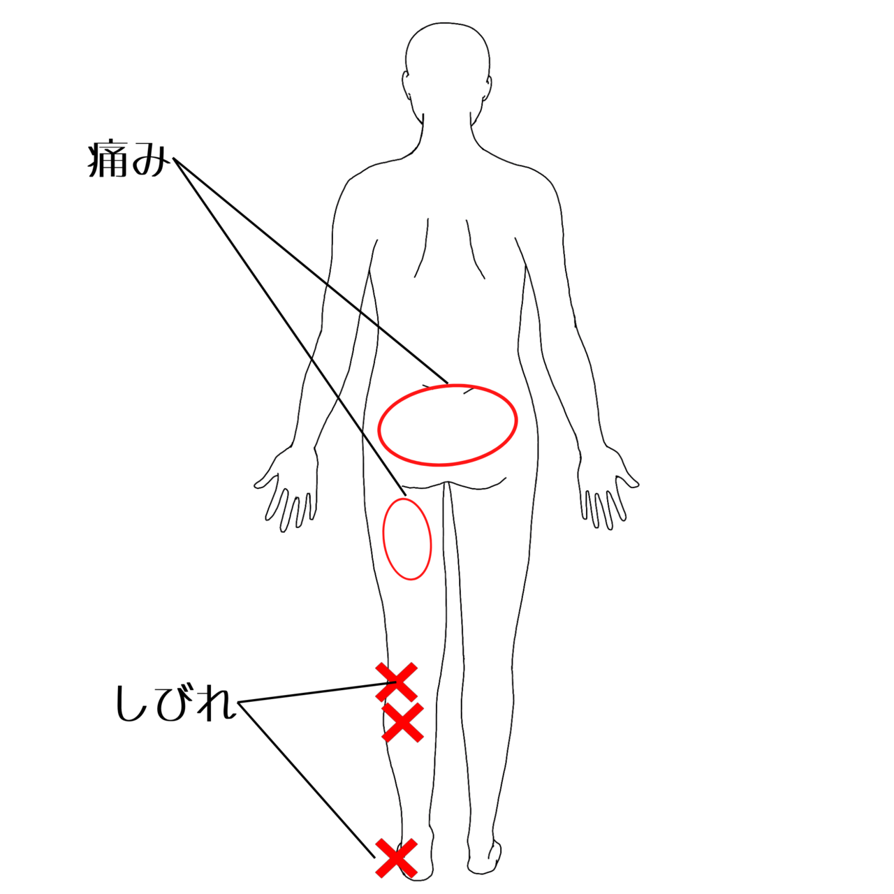 痛みの部位イラスト