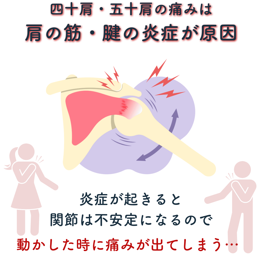 四十肩、五十肩の原因は肩の筋・腱の炎症が原因です。炎症が起こると関節は不安定になるので動かしたときに痛みがでます。