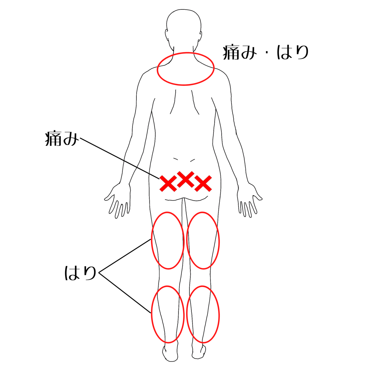 痛みの部位イラスト