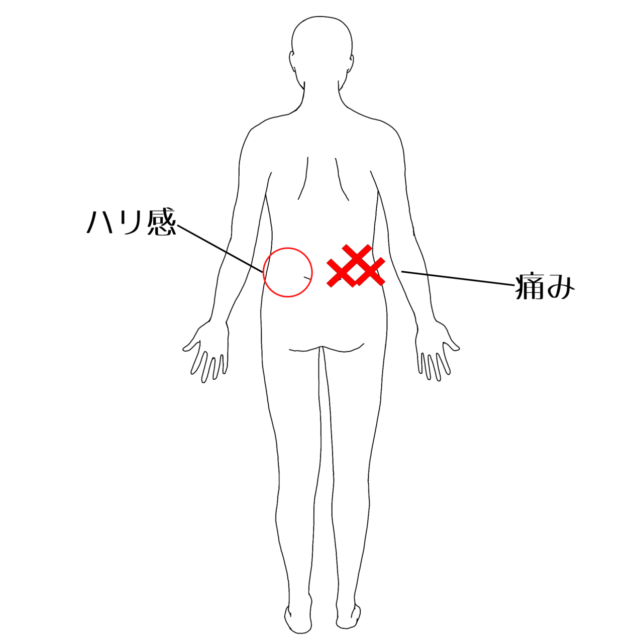 痛みの位置のイラスト