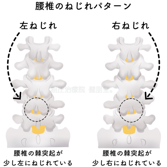 腰椎椎間板内治療のすべて―的確な診断と最適な治療を求めて Amazon.co.jp: 腰椎椎間板内治療のすべて: ~的確な診断と最適な